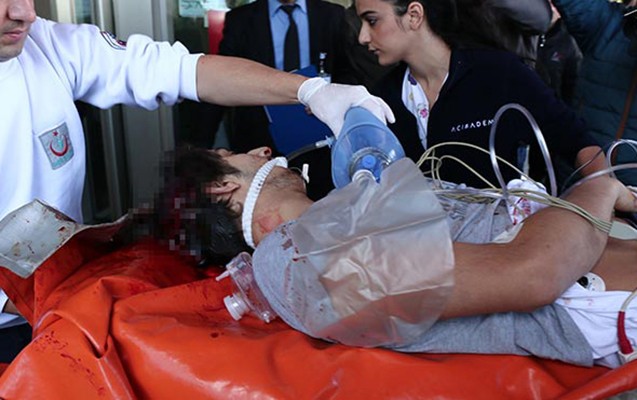 Ərdoğanın evinin qarşısına &ouml;z&uuml;n&uuml; g&uuml;llələdi - Fotolar