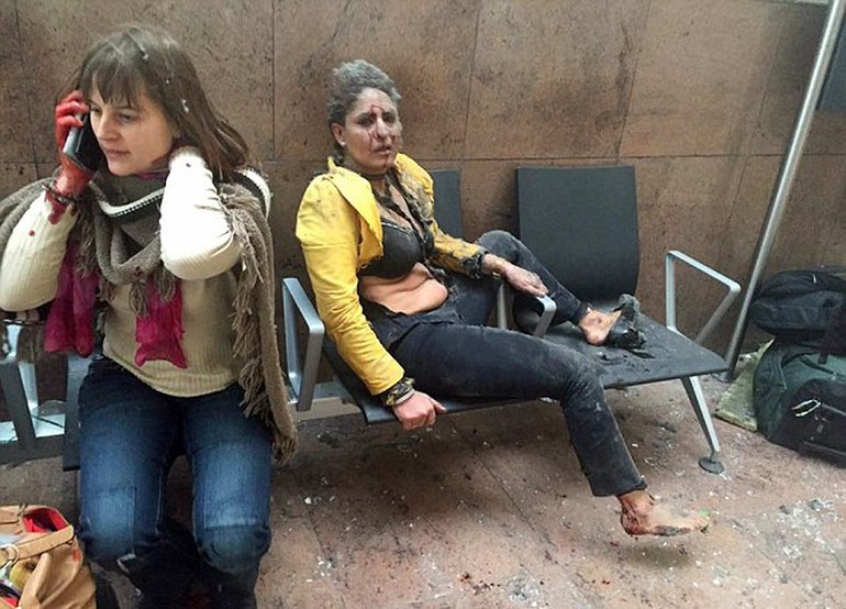 Belçika terrorunda yaddaşlarda qalan -  Üzü qanlı qadın + Foto