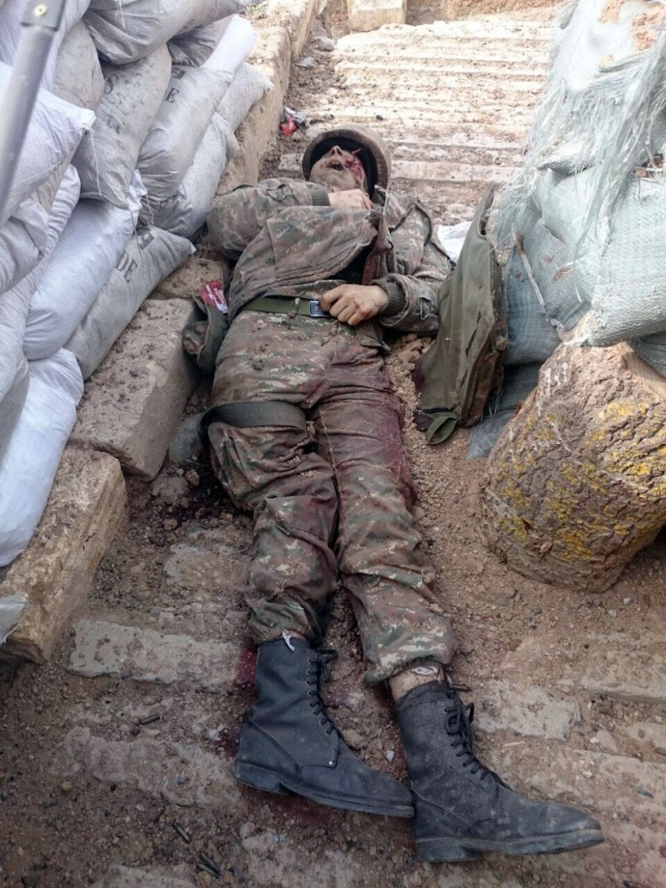 Ermənilərin qoyub qaçdığı meyitlər -  Fotolar Ermənilərin qoyub qaçdığı meyitlər -  Fotolar