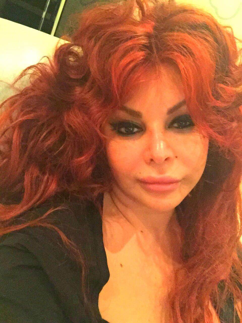 “Xaricə ağır xəstəliyə görə yox, estetik əməliyyata getmişdim...” -  Fotolar