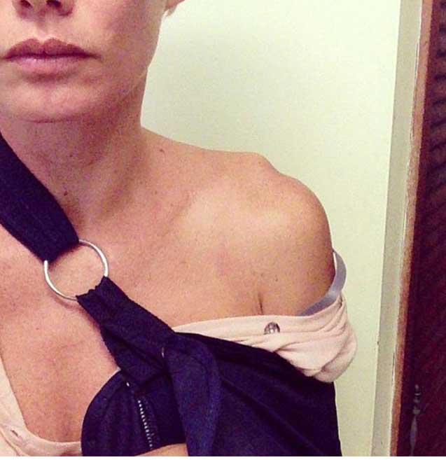 &Ccedil;əkiliş zamanı qəza ke&ccedil;irdi -  Sol qolu kəsildi + Fotolar