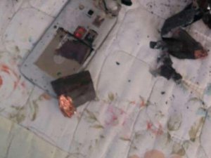 Bakı sakininin telefonu partladı, uşağın dili tutuldu -  Foto