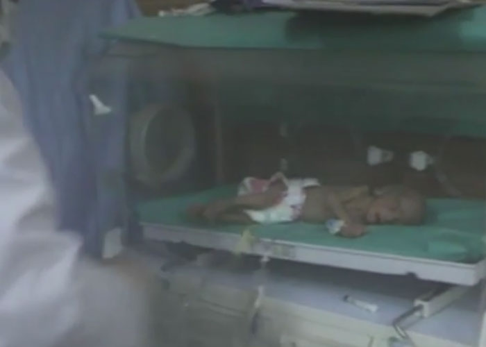 Hələbdəki sonuncu xəstəxana bombardman edildi - Dəhşətli fotolar