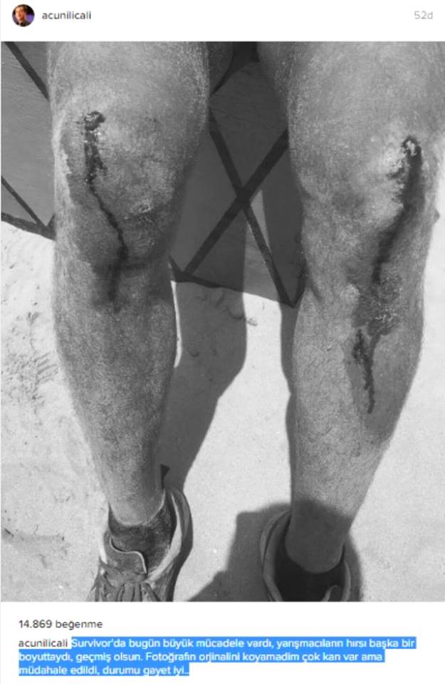 “Survivor”da nə baş verir?